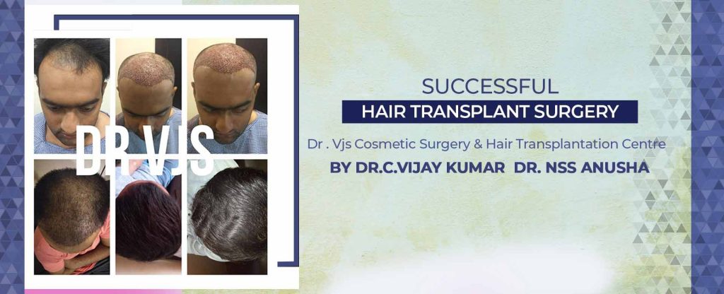 Keywords: Hair transplant in Vizag,