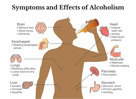 What is alcohol use disorder, and what is the treatment?