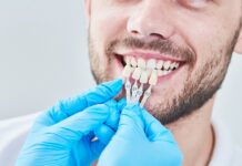 What is the Procedure for Acquiring Dental Veneers - Dental Clinic London