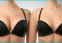 easy way to reduce breast size