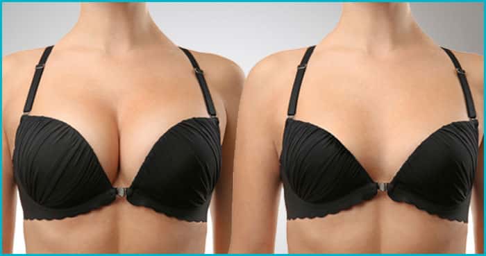 easy way to reduce breast size