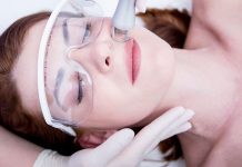 6 Surprising Advantages of Laser Skin Resurfacing Treatments