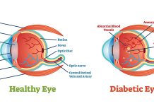 diabetic eye disease featured image