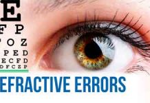 Refractive errors featured image