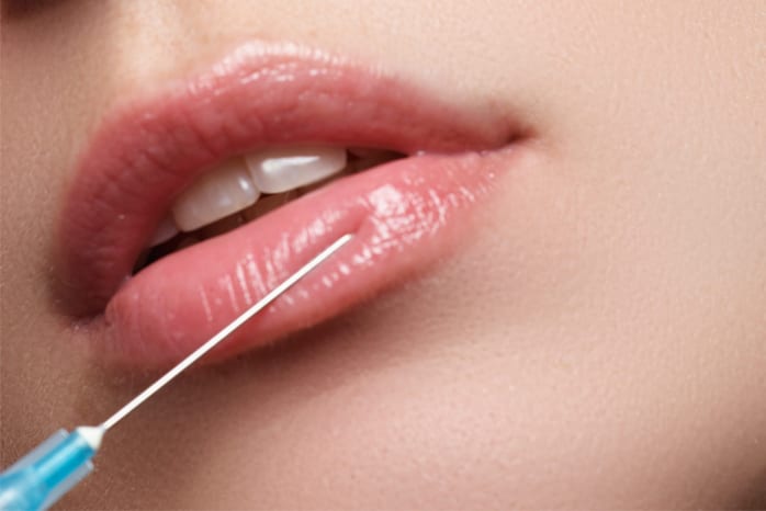 Lip Fillers Injections in Dubai, Abu Dhabi & Sharjah - UAE